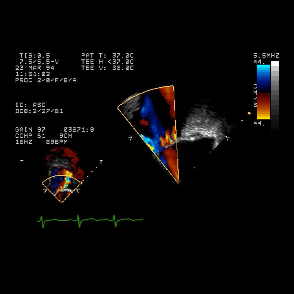 Sample 1 Dicom (DCM) file